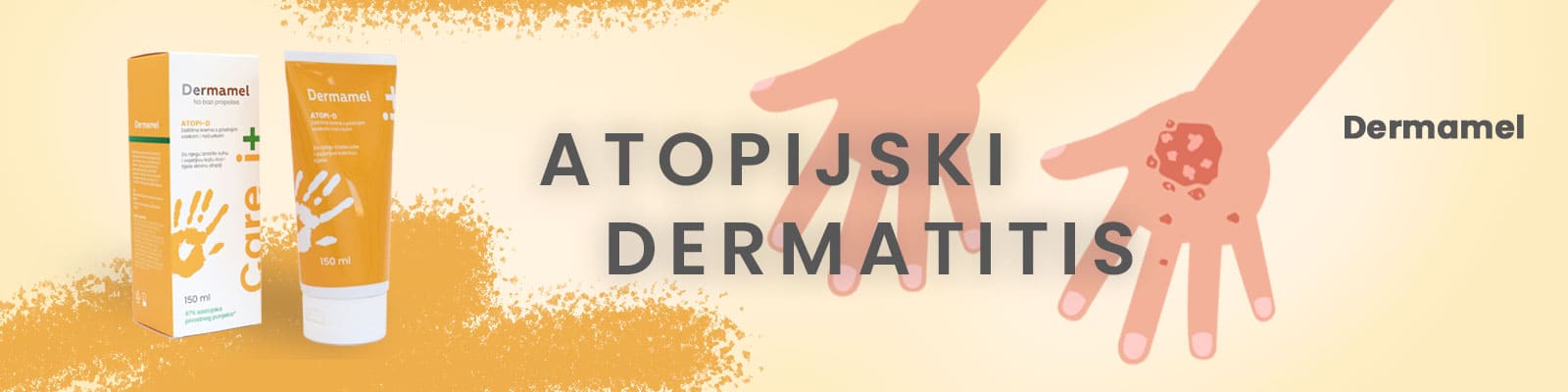 atopijski dermatitis